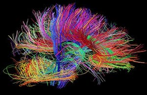 brain mapping
